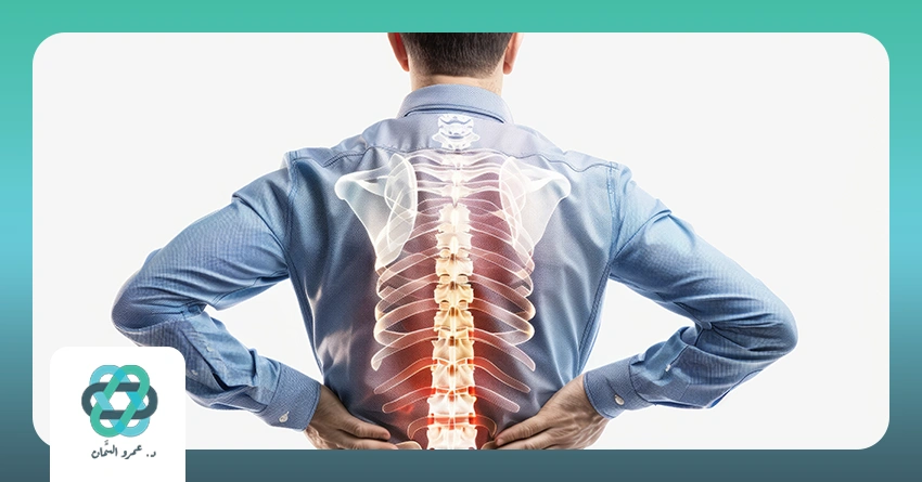 عمليات تثبيت الفقرات بالمنظار